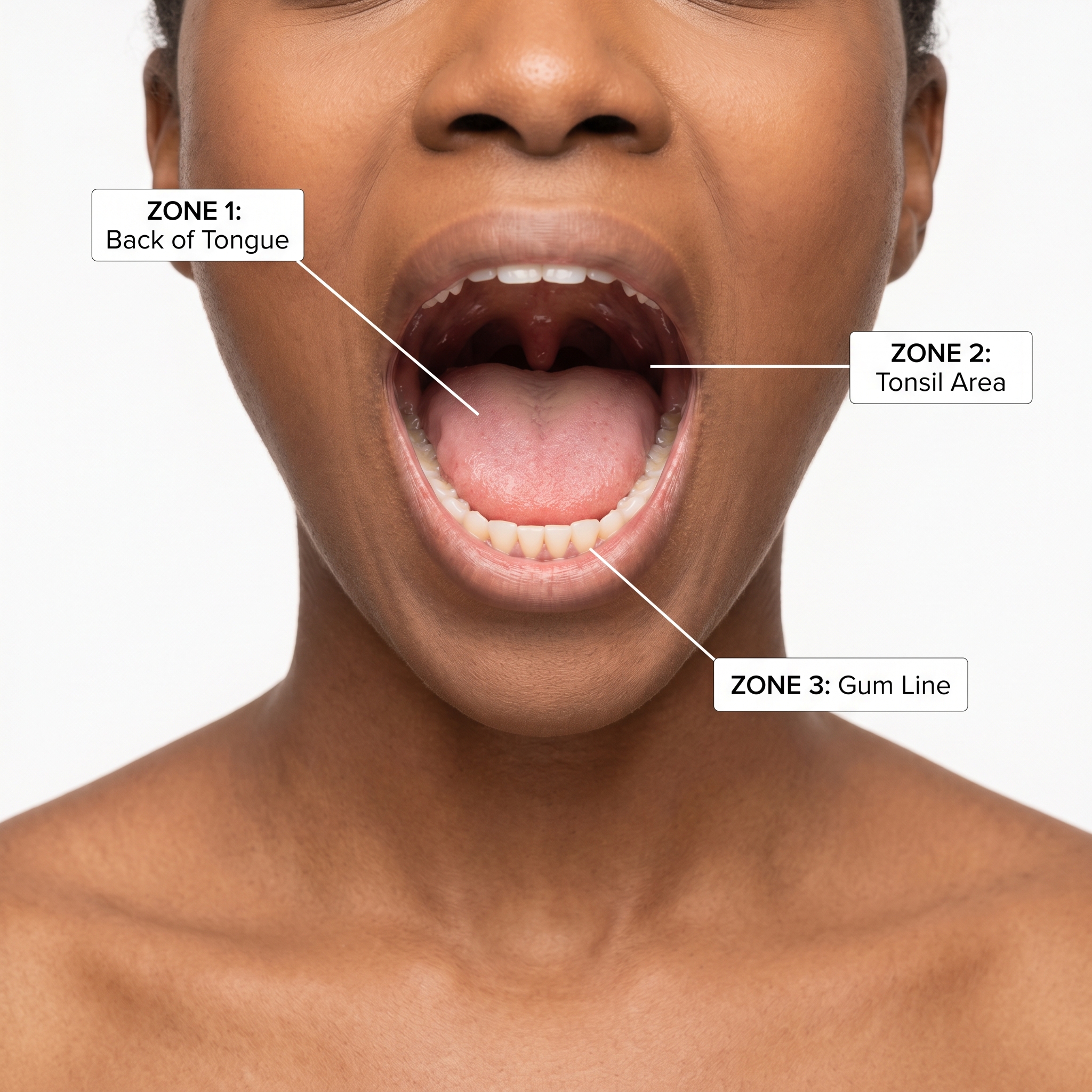 The 3 bacterial zones in the human mouth